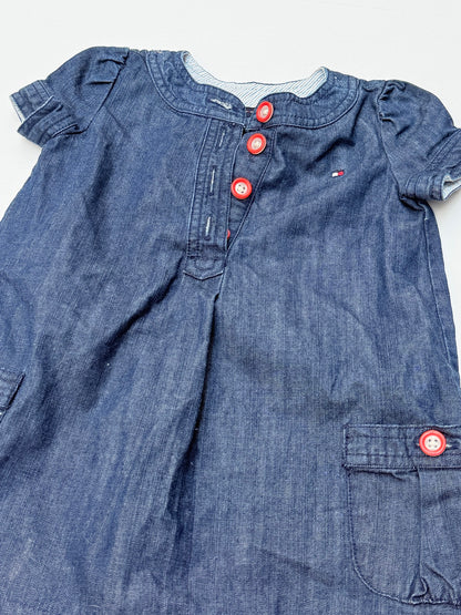 Tommy Hilfiger Denim Cargo Pocket Dress 2T